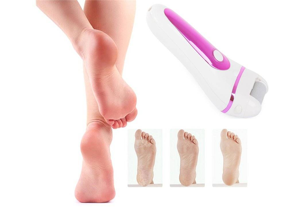 Dispozitiv electric pentru indepartarea calusurilor si ingrijirea calcaielor, cu rezultate vizibile. Pila LCD multicolor 