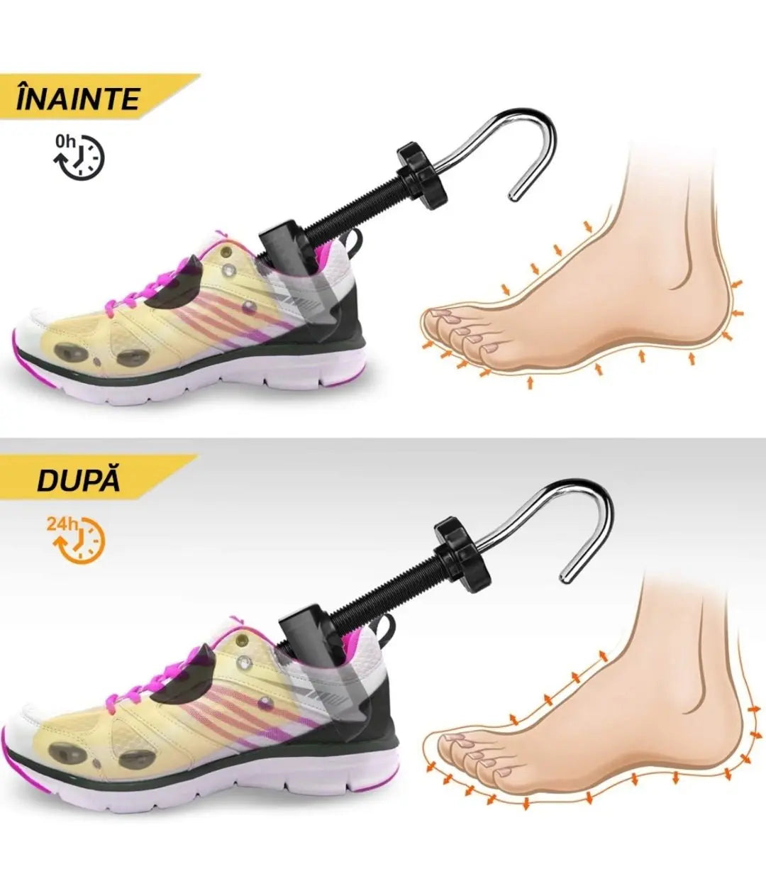 Set 2 Sanuri/Calapod Reglabile, 39 - 43 pentru Alungit si Largit Pantofi, ABS Premium, Unisex, Arc, Galben - Cumpara24