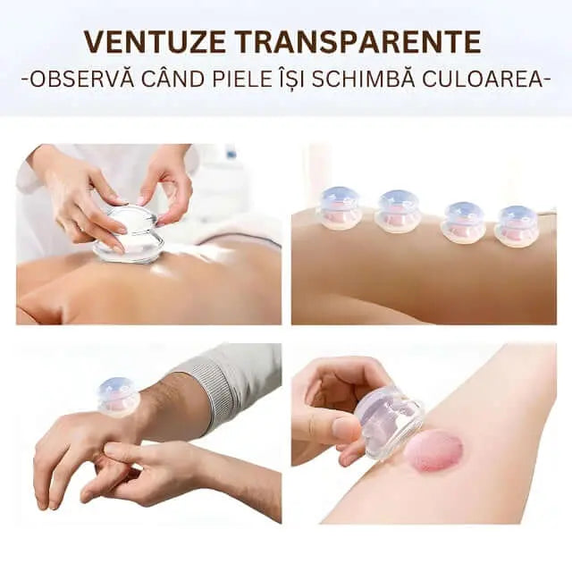 Set 4 Ventuze de Cupping Terapeutice pentru Masaj Anticelulitic si Relaxare, din Silicon, Alb Transparent - Cumpara24