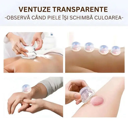 Set 4 Ventuze de Cupping Terapeutice pentru Masaj Anticelulitic si Relaxare, din Silicon, Alb Transparent - Cumpara24