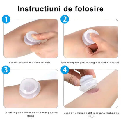 Set 4 Ventuze de Cupping Terapeutice pentru Masaj Anticelulitic si Relaxare, din Silicon, Alb Transparent - Cumpara24